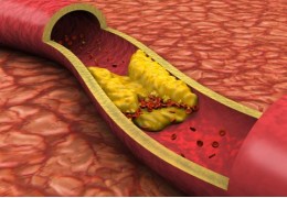 Control del Colesterol en Enero: Hábitos y Suplementos Naturales para Cuidar tu Corazón ✨